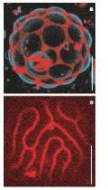 (Phase separation in a lipid membrane, by Peter Olmsted, Leeds.)
